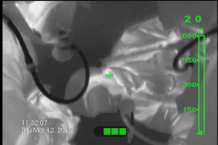 Wärmebildkamera Bullard Eclipse LD - 2